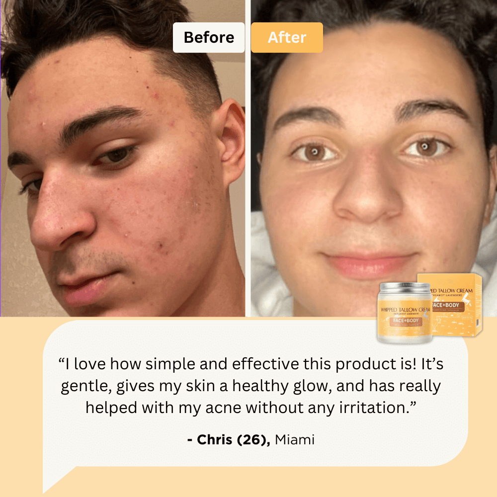 Lorant™ - Tallow Balm